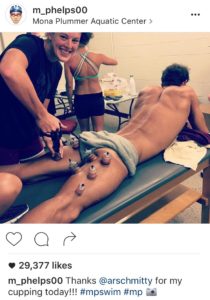 Michael Phelps posted a photo of his cupping therapy on his Instagram account.